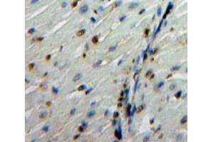 IHC-P analysis of Heart tissue, with DAB staining. (Glucocorticoid Receptor anticorps  (AA 532-730))