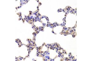 Immunohistochemistry of paraffin-embedded Mouse lung using NR5A2 antibody at dilution of 1:100 (x400 lens). (NR5A2 + LRH1 anticorps)