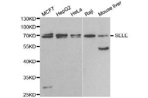 Western blot analysis of extracts of various cell lines, using SELE antibody. (Selectin E/CD62e anticorps  (AA 22-230))
