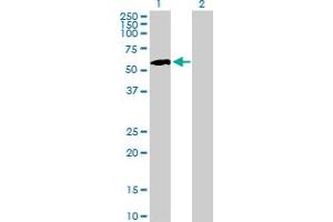 Western Blot analysis of IP6K1 expression in transfected 293T cell line by IP6K1 MaxPab polyclonal antibody. (IP6K1 anticorps  (AA 1-441))