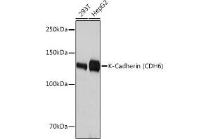 Western blot analysis of extracts of various cell lines, using K-Cadherin (CDH6) Rabbit mAb (ABIN1680831, ABIN3019147, ABIN3019148 and ABIN7101722) at 1:3000 dilution.