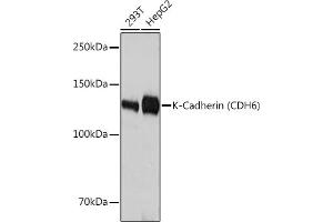Western blot analysis of extracts of various cell lines, using K-Cadherin (CDH6) Rabbit mAb (ABIN1680831, ABIN3019147, ABIN3019148 and ABIN7101722) at 1:3000 dilution. (CDH6 anticorps)