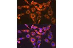 Immunofluorescence analysis of NIH-3T3 cells using IMPDH2 Rabbit mAb  at dilution of 1:100 (40x lens).