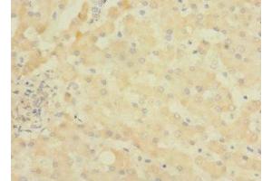 Immunohistochemistry of paraffin-embedded human liver tissue using ABIN7144737 at dilution of 1:100 (ASPHD1 anticorps  (AA 96-390))