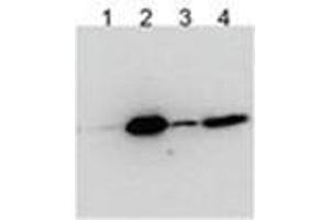 HEK293 overexpressing Human BICC1 with N-terminal FLAG, probed with Rabbit anti-BCC1 in Western Blot after IP using either AP31787PU-N or anti-FLAG antibody in the presence or absence of SDS.