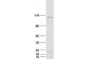 Validation with Western Blot