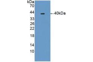 Detection of Recombinant PLA2R1, Mouse using Polyclonal Antibody to Phospholipase A2 Receptor 1 (PLA2R1) (PLA2R1 anticorps  (AA 1418-1487))