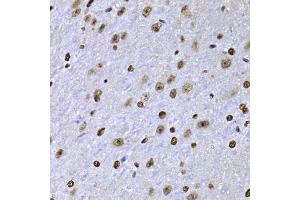 Immunohistochemistry of paraffin-embedded mouse brain using SOX5 antibody.