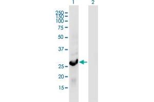 Western Blot analysis of RGS18 expression in transfected 293T cell line by RGS18 monoclonal antibody (M01A), clone 1H6.