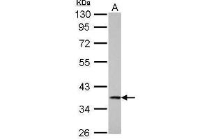 WB Image Cathepsin S antibody detects CTSS protein by Western blot analysis.
