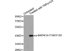 Western blot analysis of extracts from Hela cells using Phospho-MAPK14-T180/Y182 antibody. (MAPK14 anticorps  (pThr180, pTyr182))