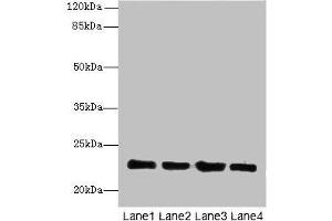 Western blot All lanes: HPCAL4 antibody at 2 μg/mL Lane 1: Mouse brain tissue Lane 2: Mouse kidney tissue Lane 3: Mouse ovarian tissue Lane 4: Human placenta tissue Secondary Goat polyclonal to rabbit IgG at 1/10000 dilution Predicted band size: 22 kDa Observed band size: 22 kDa (HPCAL4 anticorps  (AA 2-191))