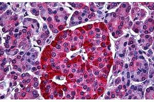 Human Pancreas, Islets of Langerhans: Formalin-Fixed, Paraffin-Embedded (FFPE) (STXBP1 anticorps  (AA 74-169))