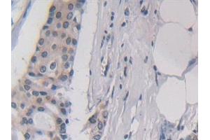anti-Interleukin 5 (IL5) (AA 20-134) antibody