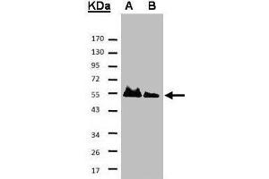 Western blot analysis of A: His-Hice1 (2x); B: His-Hice1 (1x) using a 7. (NYS48/HAUS8 anticorps)