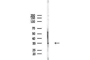 anti-Potassium Channel Tetramerisation Domain Containing 12 (KCTD12) (Internal Region) antibody