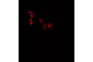 ABIN6266452 staining A549 cells by IF/ICC. (EPHA2/3/4 anticorps  (pTyr588, pTyr596))