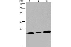 Western Blot analysis of Human fetal brain tissue and 293T cell using RAB3c Polyclonal Antibody at dilution of 1:400 (Rab3c anticorps)
