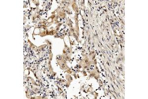 IHC analysis of MED4 using anti-MED4 antibody (ABIN7600817). (MED4 anticorps  (AA 24-254))