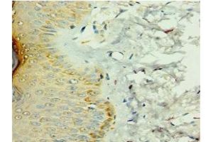 Immunohistochemistry of paraffin-embedded human skin tissue using ABIN7156908 at dilution of 1:100 (FIL1d anticorps  (AA 1-155))