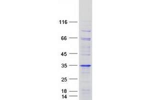 Validation with Western Blot
