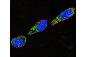 Confocal immunofluorescent analysis of Src antibody with A375 cells followed by Alexa Fluor 488-conjugated goat anti-rabbit lgG (green).