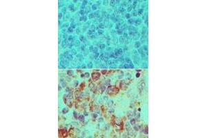 anti-Importin 7 (IPO7) (AA 1-50) antibody