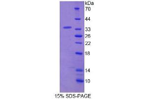 SDS-PAGE analysis of Human NASP Protein.