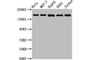 Western Blot Positive WB detected in: Hela whole cell lysate, MCF-7 whole cell lysate, HepG2 whole cell lysate, K562 whole cell lysate, Jurkat whole cell lysate All lanes: HDAC6 antibody at 1.