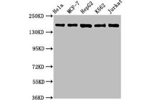 Western Blot Positive WB detected in: Hela whole cell lysate, MCF-7 whole cell lysate, HepG2 whole cell lysate, K562 whole cell lysate, Jurkat whole cell lysate All lanes: HDAC6 antibody at 1. (Recombinant HDAC6 anticorps)