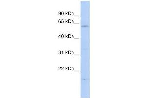 Western Blotting (WB) image for anti-F-Box and WD Repeat Domain Containing 11 (FBXW11) antibody (ABIN2458711) (FBXW11 anticorps)
