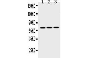 Western blot analysis of EPHX2 expression in rat lung extract ( Lane 1), mouse lung extract ( Lane 2) and HEPG2 whole cell lysates ( Lane 3). (EPHX2 anticorps  (C-Term))