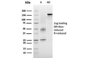 SDS-PAGE Analysis Purified VISTA Monospecific Mouse Monoclonal Antibody (VISTA/3007).