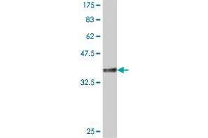 Western Blot detection against Immunogen (37.