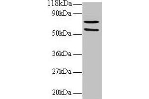 Western blot All lanes: SDHA antibody at 2 μg/mL + 293T whole cell lysate Secondary Goat polyclonal to rabbit IgG at 1/15000 dilution Predicted band size: 73, 68, 57 kDa Observed band size: 73, 57 kDa