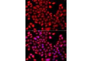 Immunofluorescence analysis of A549 cells using RARG antibody (ABIN5975541). (Retinoic Acid Receptor gamma anticorps)