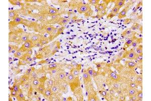 Immunohistochemistry of paraffin-embedded human liver tissue using ABIN7149238 at dilution of 1:100