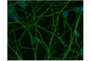 Immunofluorescence (IF) image for anti-Small Nuclear Ribonucleoprotein Polypeptide N (SNRPN) (AA 14-174) antibody (ABIN968086) (SNRPN anticorps  (AA 14-174))