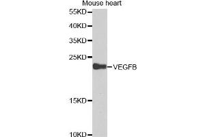 Western blot analysis of extracts of mouse heart cell lines, using VEGFB antibody. (VEGFB anticorps)
