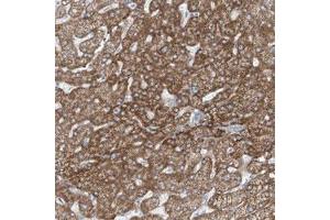 Immunohistochemical staining (Formalin-fixed paraffin-embedded sections) of human liver with TENC1 polyclonal antibody  shows moderate cytoplasmic positivity in hepatocytes.