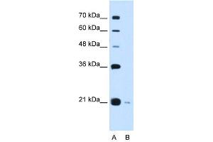 XTP3TPA antibody used at 0. (DCTPP1 anticorps  (Middle Region))