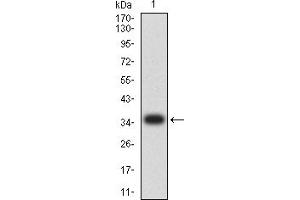 Western blot analysis using CD224 mAb against human CD224 (AA: extra 381-470) recombinant protein.