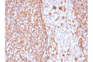 Formalin-fixed, paraffin-embedded human Tonsil stained with Vimentin Rabbit Recombinant Monoclonal Antibody (VIM/1937R).