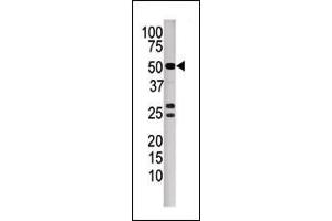 Western blot analysis of anti-P3CB Pab (ABIN392893 and ABIN2842292) in mouse kidney tissue lysate.
