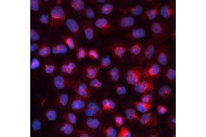 IF analysis of TFRC using anti-TFRC antibody (ABIN3043538). (Transferrin Receptor anticorps  (AA 1-198))