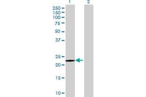 Western Blot analysis of SAP30L expression in transfected 293T cell line ( H00079685-T01 ) by SAP30L MaxPab polyclonal antibody. (SAP30L anticorps  (AA 1-183))
