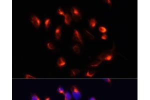 Immunofluorescence analysis of U2OS cells using CYP3A4 Polyclonal Antibody at dilution of 1:100. (CYP3A4 anticorps)