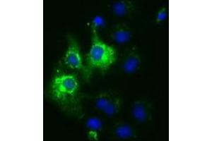 Anti-CYB5R3 mouse monoclonal antibody (ABIN2452925) immunofluorescent staining of COS7 cells transiently transfected by pCMV6-ENTRY CYB5R3 (RC201592). (CYB5R3 anticorps)