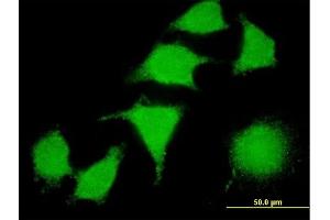 Immunofluorescence of monoclonal antibody to LIMK2 on HeLa cell.