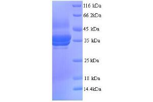 SDS-PAGE (SDS) image for Annexin A5 (ANXA5) (AA 1-323), (full length) protein (His tag) (ABIN5713228)